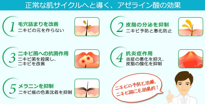 �A�N�l�N���A���[�V�������`�y�Z�������e�t