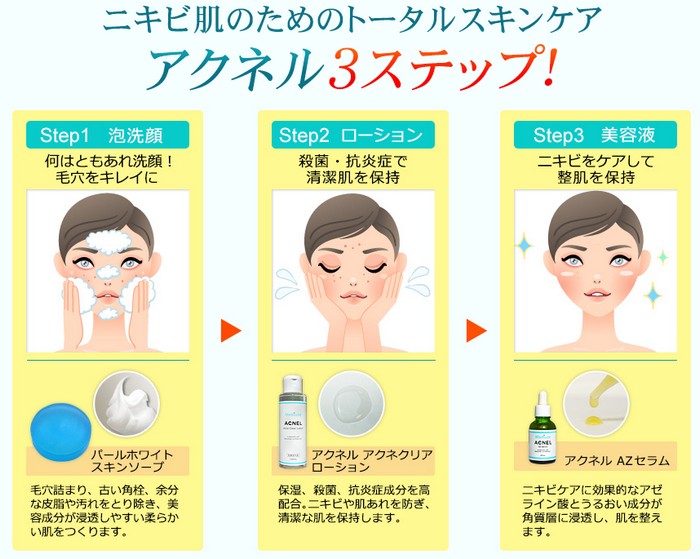 �A�N�l�N���A���[�V�������`�y�Z�������e�t