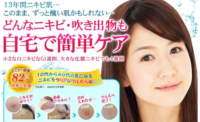 �A�N�l�N���A���[�V�������`�y�Z�������e�t